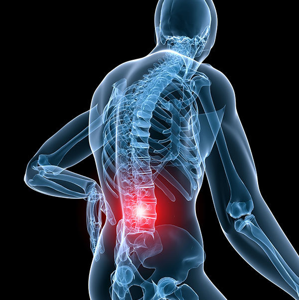 Understanding the Profound Effects of Spinal Injuries After a Car Accident