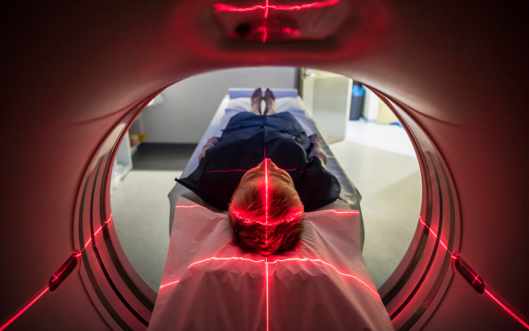 Traumatic Brain Injuries and Long Term Care Traumatic Brain Injuries and Long Term Care
