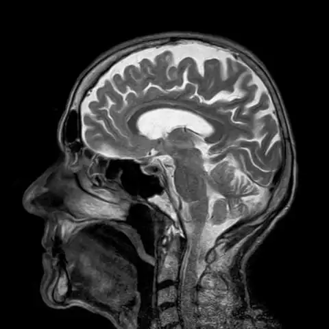 Brain injury lawyers Brain injury lawyers