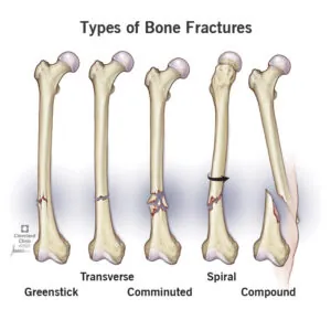 The Most Common Injuries from Car Accidents