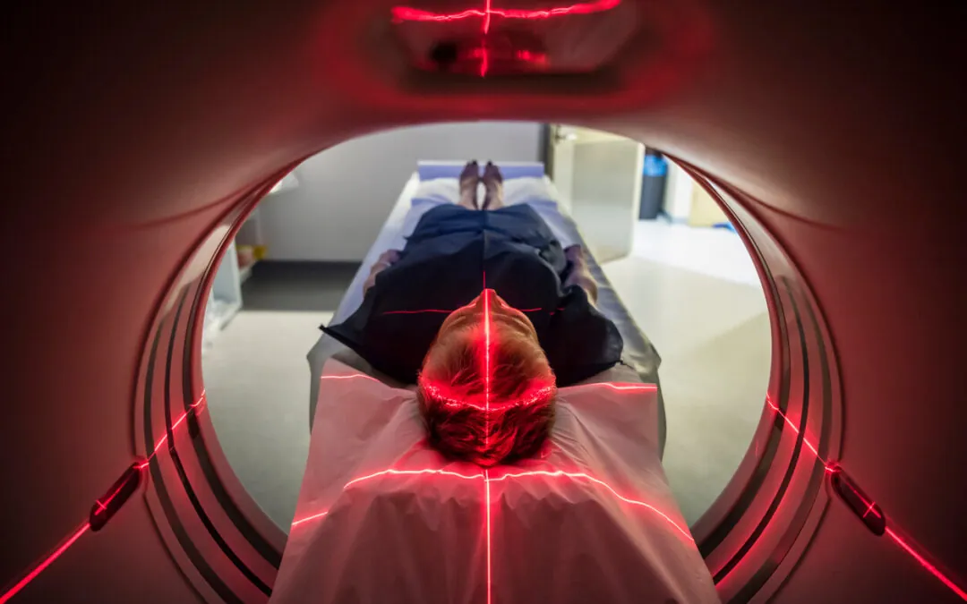 Traumatic Brain Injuries and Long Term Care Traumatic Brain Injuries and Long Term Care